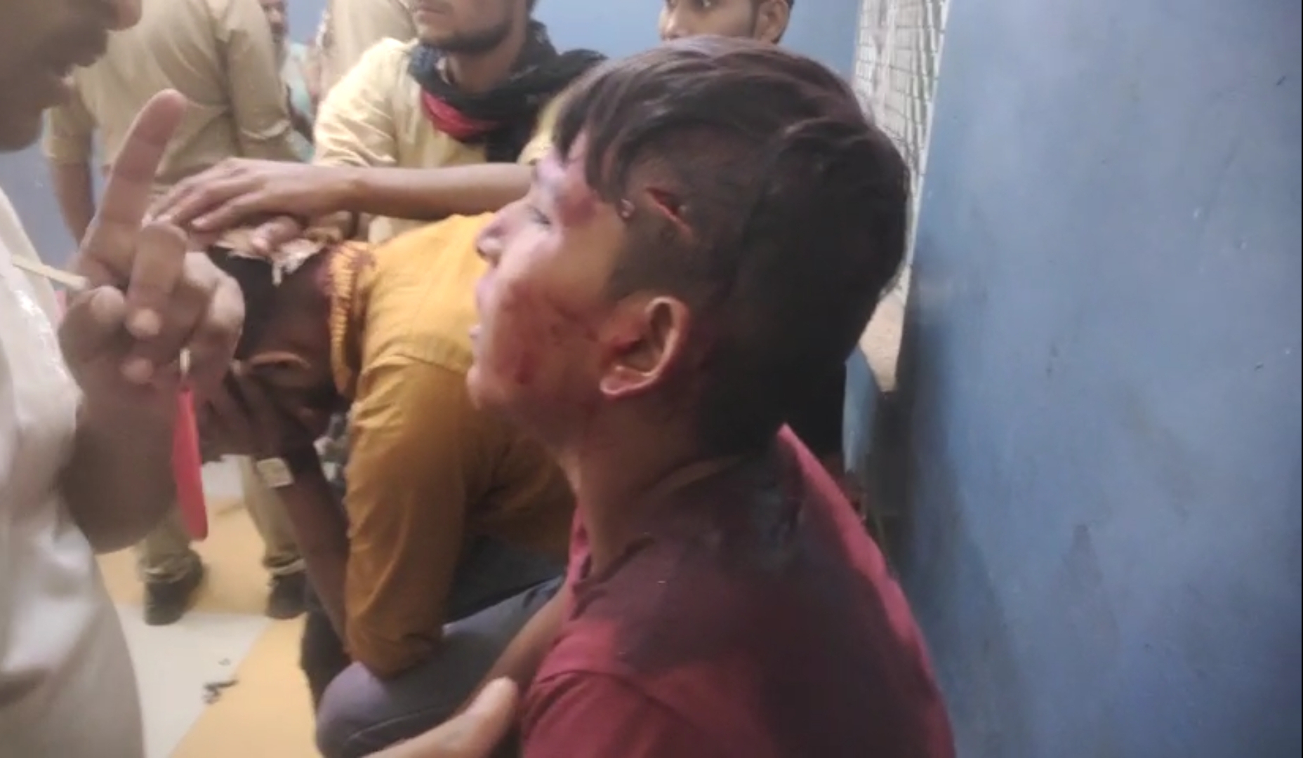 BANDA NEWS: पुलिस की मौजूदगी में देवी विसर्जन कर लौट रहे श्रद्धालुओं पर चले पत्थर, तीन के फटे सर